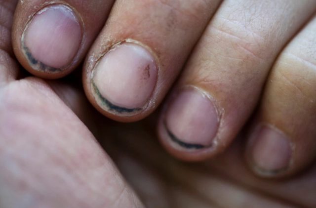 smutsiga naglar smutsiga naglar