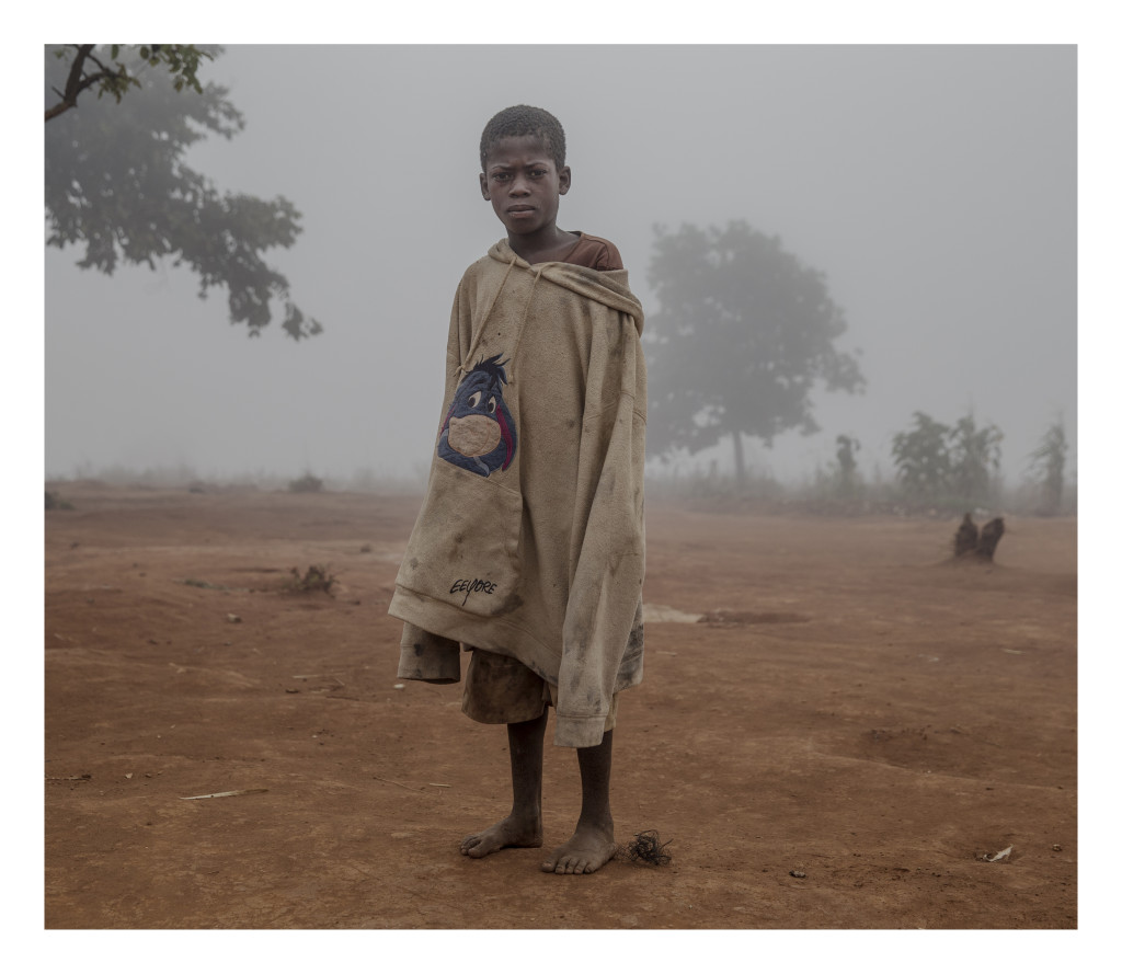 Malawi är ett av värdens fattigaste länder och extremt utsatt för klimatförändringar med torka och översvämningar. Samtidigt flyr människor in till landet från konflikter i grannländerna, framför allt från Mocambique. Situationen är också extrem för de många albinos som finns i landet de hotas av att bli mördade då deras ben och hud tros ha helande berikande krafter.