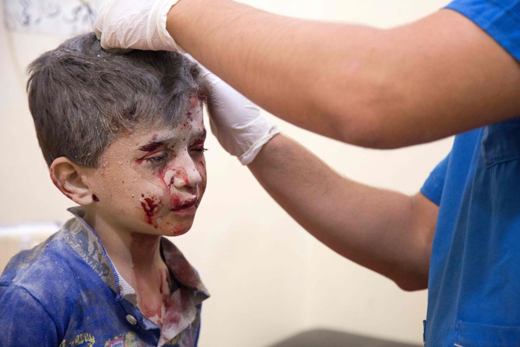 foto : karam al-masri : a syrian boy receives treatment at a make-shift hospital following air strikes on rebel-held eastern areas of aleppo on september 24, 2016.
heavy syrian and russian air strikes on rebel-held eastern areas of aleppo city killed at least 25 civilians on saturday, the britain-based syrian observatory for human rights said, overwhelming doctors and rescue workers.
/ afp photo / karam al-masri / tt / kod 444