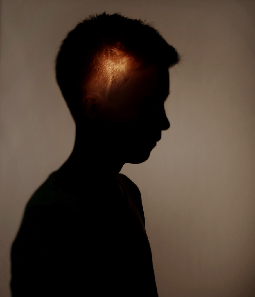 Bildreportage om barncancer.
Alexander Wassdahl, 13 år