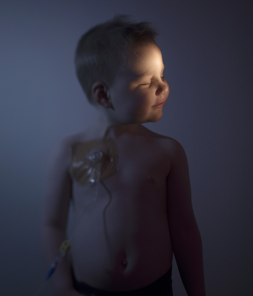 Bildreportage om barncancer.
Ester Fridholm, 3år. Leukemi.
