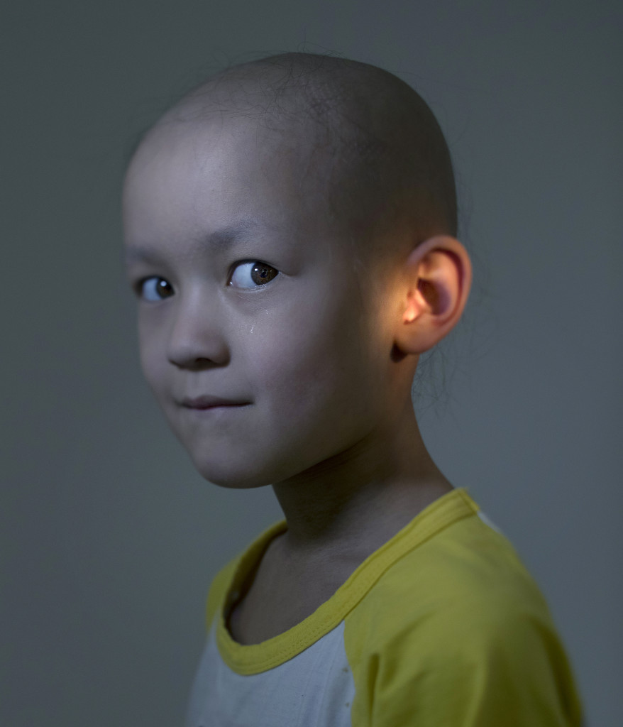 Bildreportage om barncancer.
Maja Ekström, 5. Strålas för tumör i örat