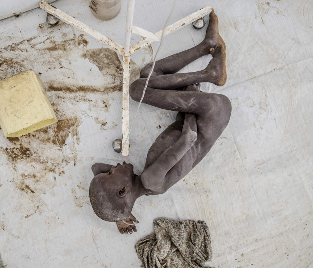 what's on the plate - vad barnen ter. frsommaren 2017 reste magnus wennman, fotograf, och erik wiman, journalist sverige aftonbladet, till platser i afrika dr hunger blivit undernring som blivit svlt. de undrade: vad ter mnniskor nr maten r slut? vad finns p barnens fat? p tallriken: smittat vatten. kolerautrbrottet i sydstra sydsudan brjade i april och r fortfarande inte under kontroll. till det hr centret i kapoeta north kommer det mellan fem och 20 ddssjuka personer om dagen. de flesta har burits hit frn avlgsna byar av slktingar som vntar p att smittas sjlva.