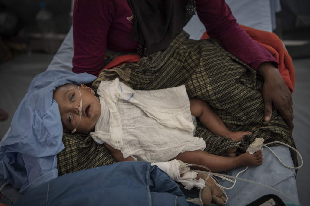 den muslimska folkgruppen rohingya i den burmesiska delstaten rakhine drivs sedan den 25 augusti 2017 p flykt under brutala former av den burmesiska militren. lilla asuma r nio mnader och vger knappt fyra kilo. ngra timmar efter att bilden tagits dr asuma.
